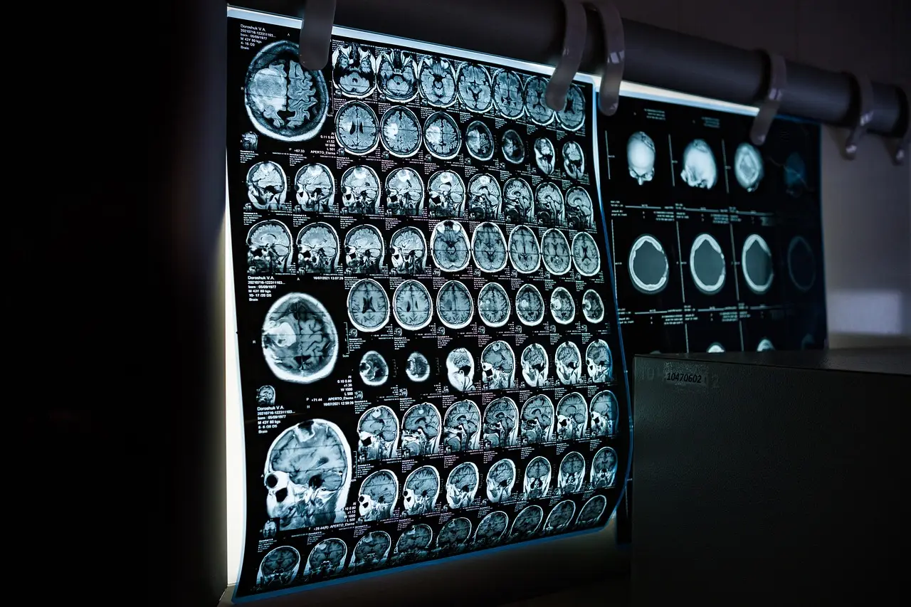 The Role of Ictal Brain Single Photon-Emission... : Current Medical Issues - Ovid