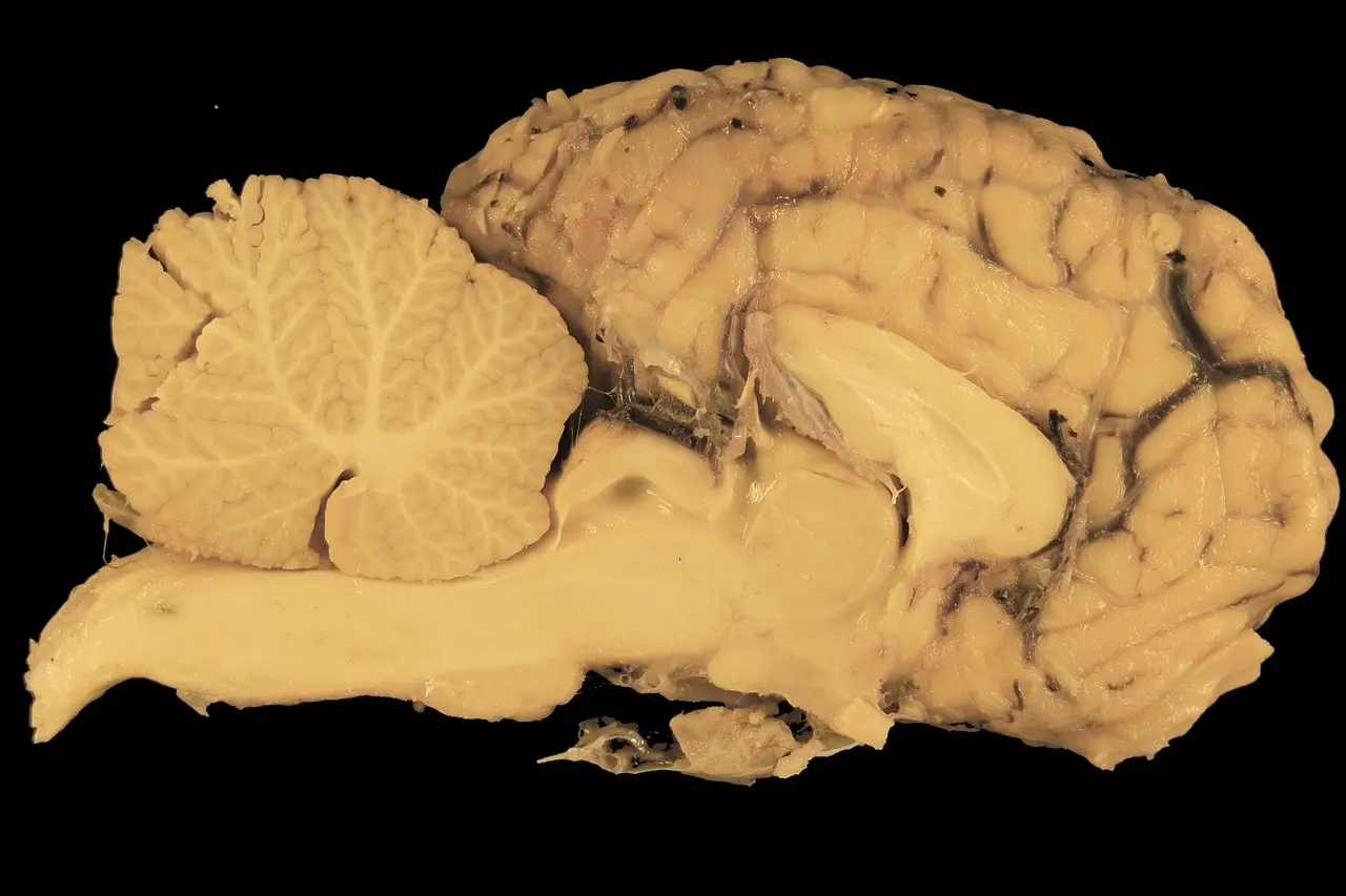Neuralink alum’s Precision Neuroscience raises $250M to advance brain-computer interfaces - Tech Funding News