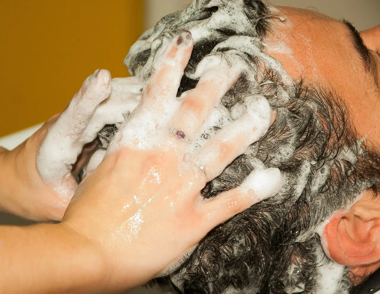 Early Ictal Dynamics in Childhood Absence Epilepsy: Scalp EEG Detection of Direct Current Shifts and High-Frequency Osci